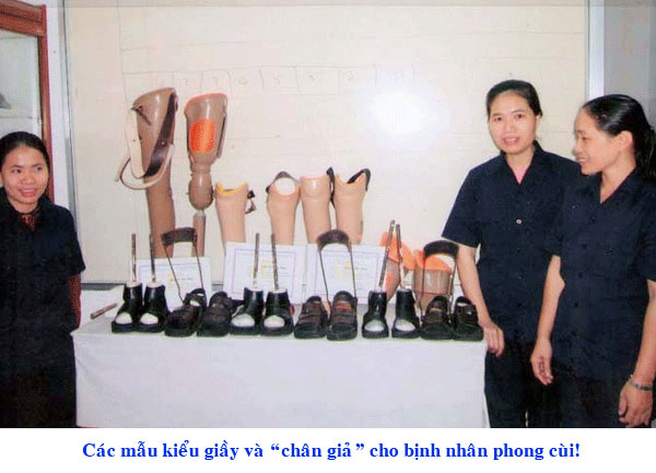 optb-chan-gia-phong-cui